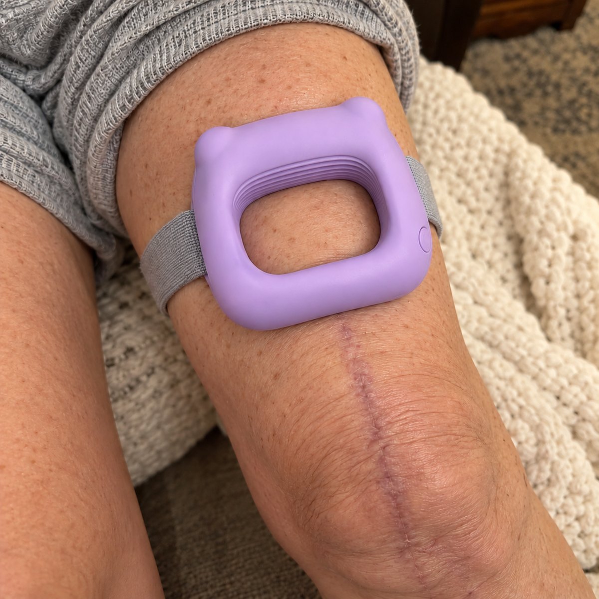 Close-up of the ring on Barbara's thigh above an old knee scar